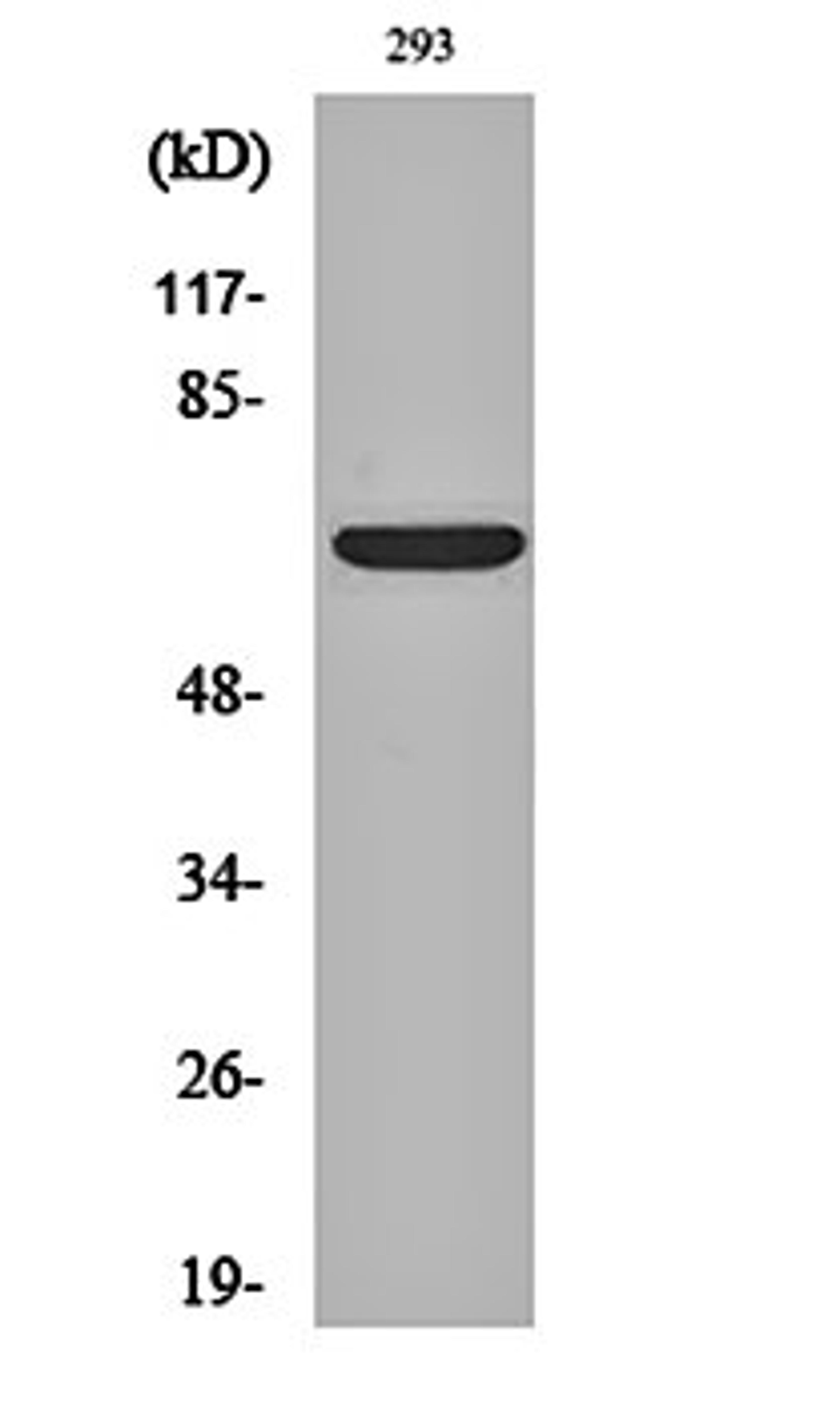 Western blot analysis of 293 cell lysates using ER alpha antibody