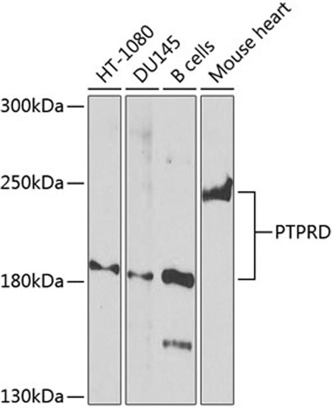 Western blot - PTPRD Antibody (A8559)