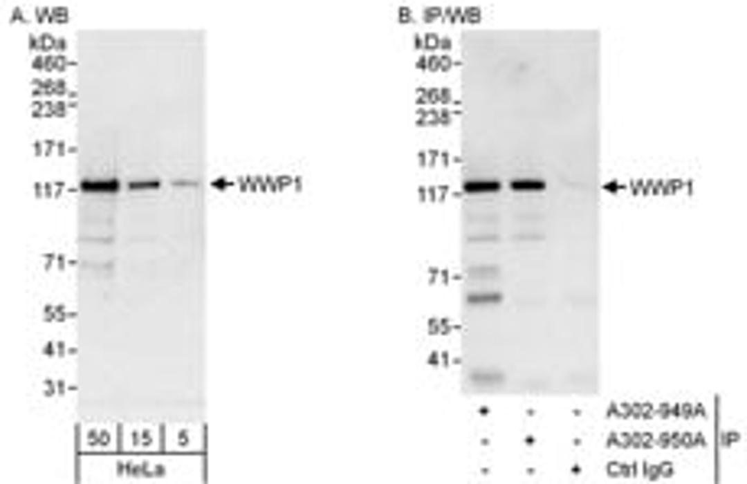 Detection of human WWP1 by western blot and immunoprecipitation.