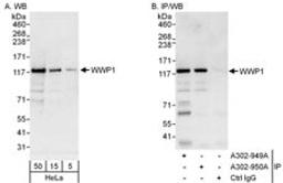 Detection of human WWP1 by western blot and immunoprecipitation.