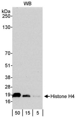 Detection of human Histone H4 by western blot.