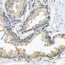 Immunohistochemical staining of rat brain tissue using CST1 antibody (dilution of 1:100)