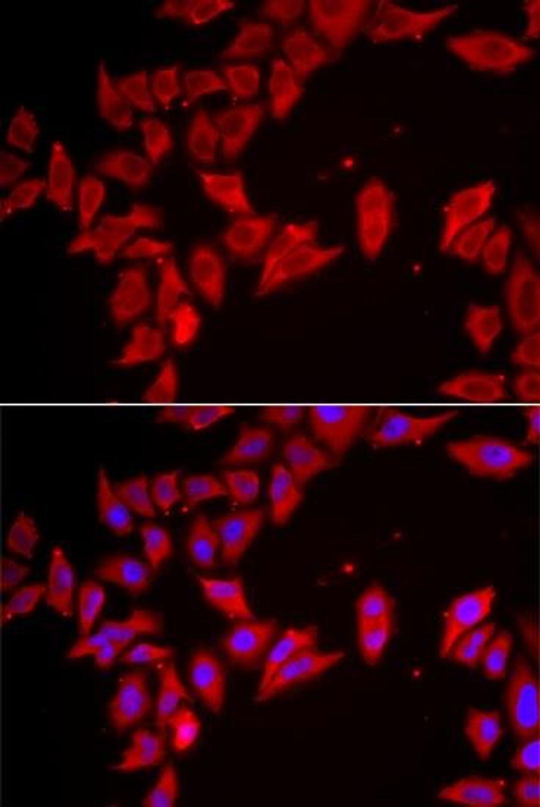 Immunofluorescence analysis of HeLa cell using SLC35A2 antibody