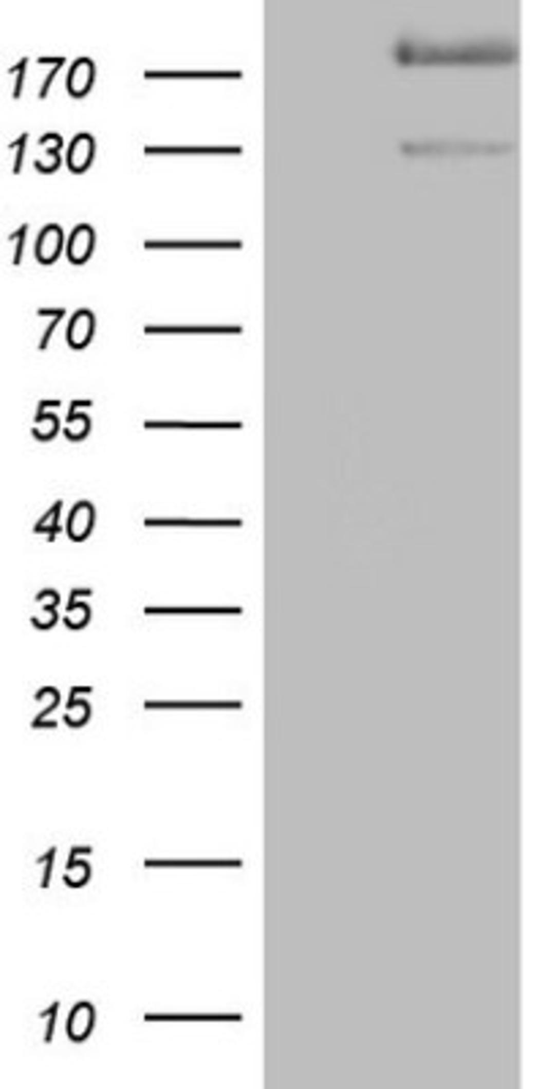 Western Blot: alpha Desmuslin Antibody (7H6) [NBP2-46044] - Analysis of HEK293T cells were transfected with the pCMV6-ENTRY control (Left lane) or pCMV6-ENTRY Desmuslin.