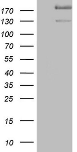 Western Blot: alpha Desmuslin Antibody (7H6) [NBP2-46044] - Analysis of HEK293T cells were transfected with the pCMV6-ENTRY control (Left lane) or pCMV6-ENTRY Desmuslin.