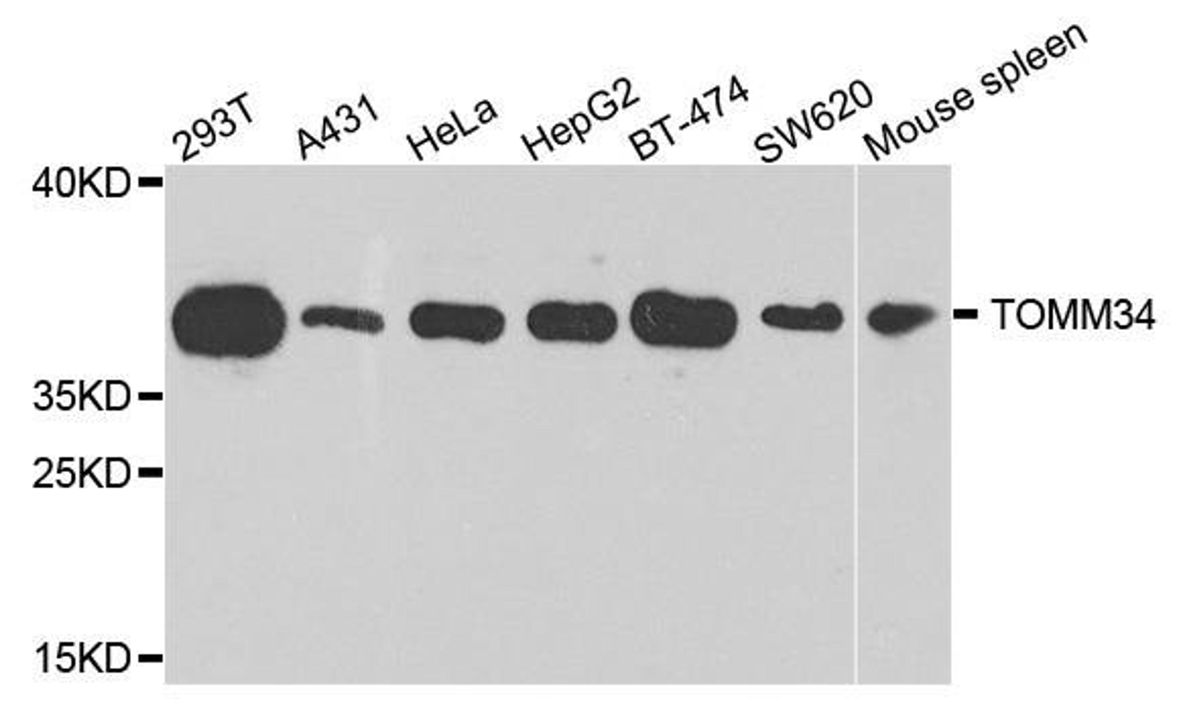 Western blot analysis of extracts of various cells using TOMM34 antibody