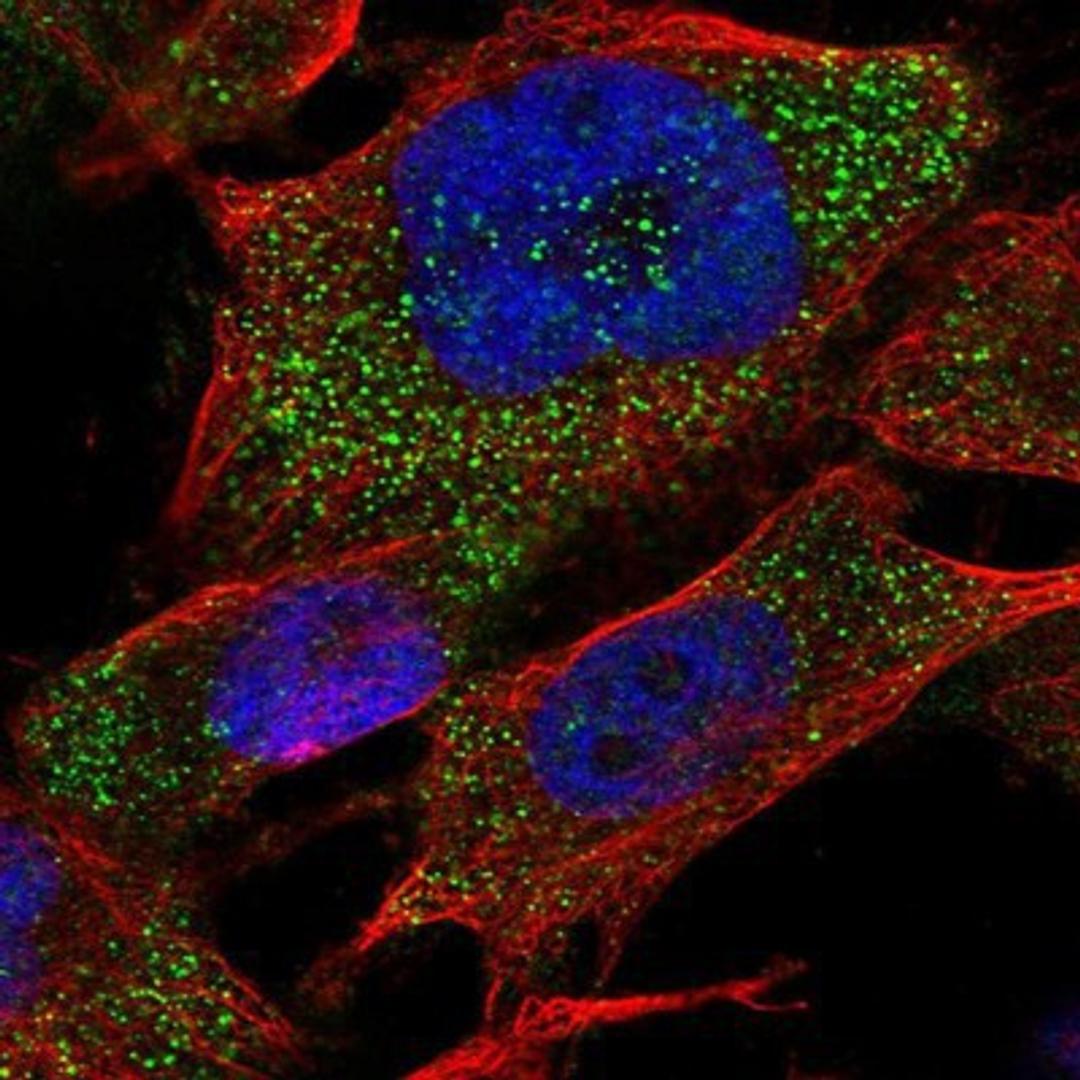 Immunocytochemistry/Immunofluorescence: RAB3GAP2 Antibody [NBP1-84199] Staining of human cell line U-251 MG shows positivity in cytoplasm.