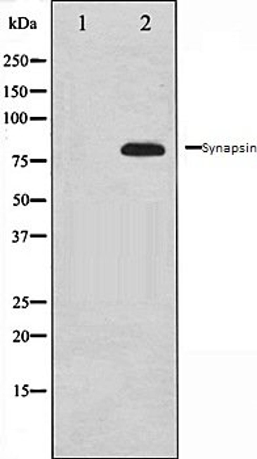 Western blot analysis of 293 whole cell lysates using Synapsin antibody, The lane on the left is treated with the antigen-specific peptide.