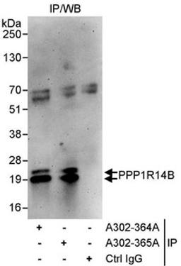 Detection of human PPP1R14B by western blot of immunoprecipitates.