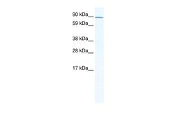 Antibody used in WB on Mouse SP2/0 at 2.5 ug/ml.