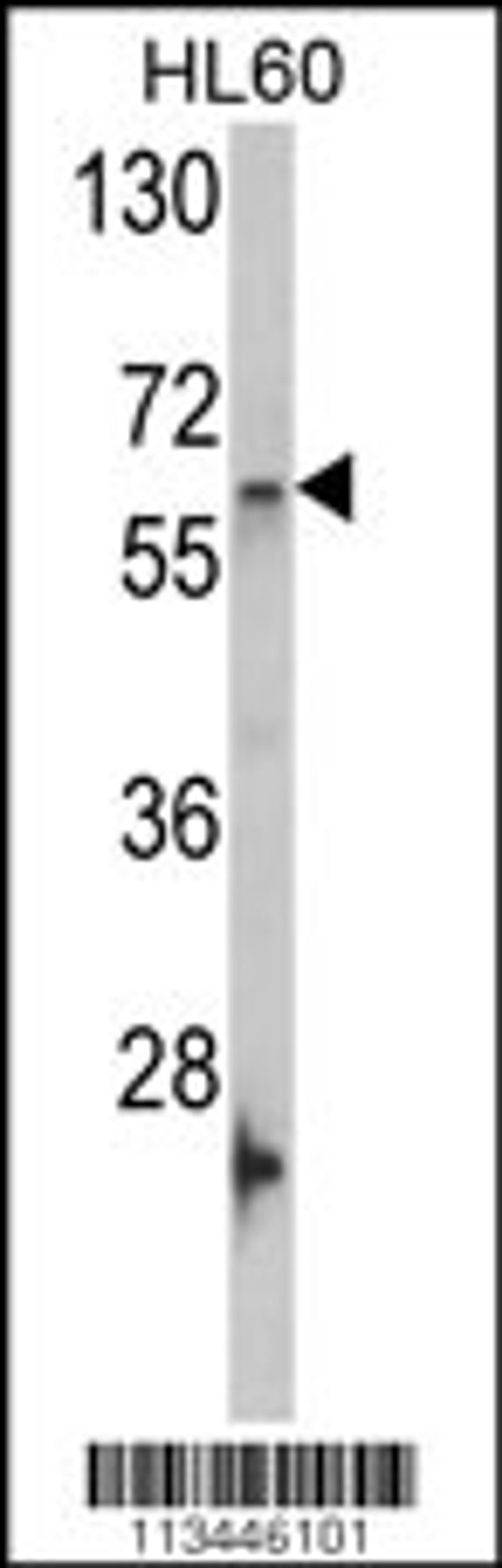 Western blot analysis of GNL3 Antibody in HL60 cell line lysates (35ug/lane)