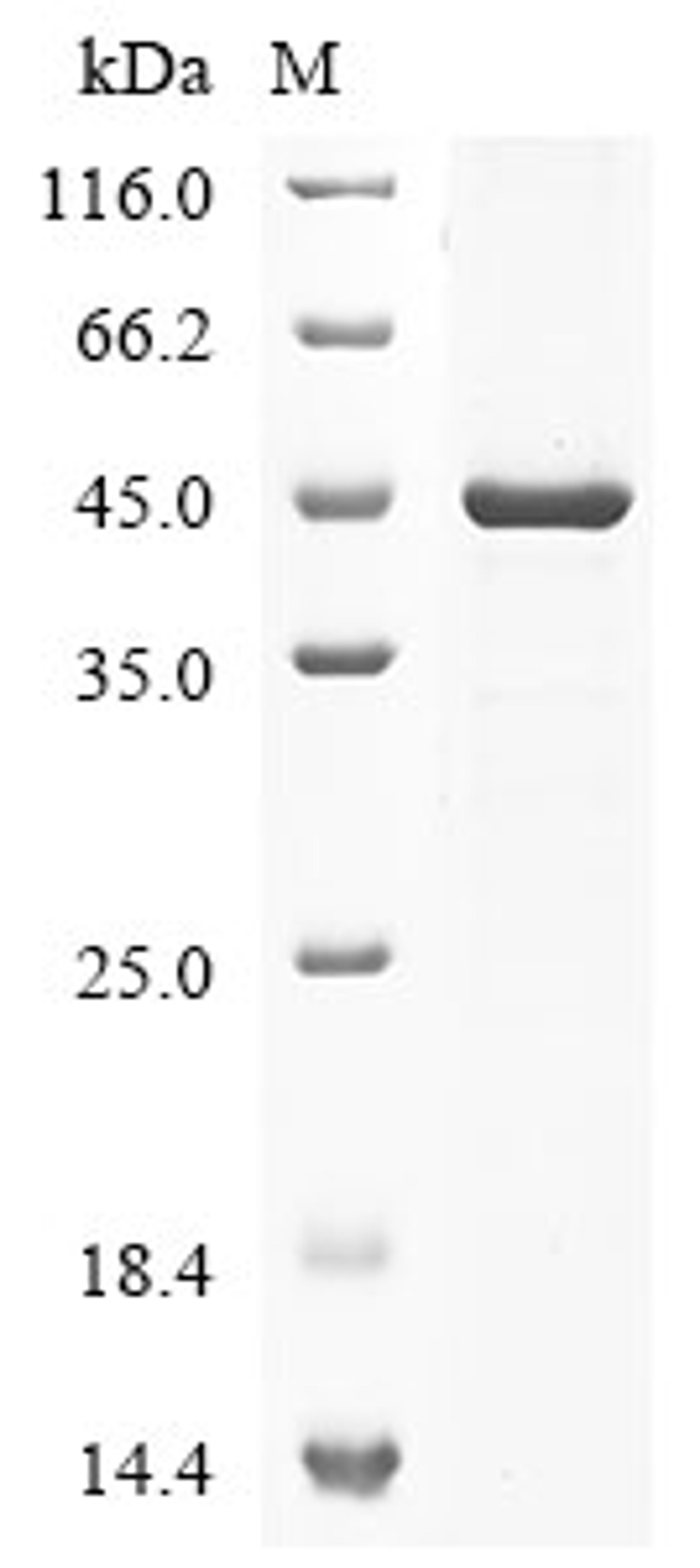 (Tris-Glycine gel) Discontinuous SDS-PAGE (reduced) with 5% enrichment gel and 15% separation gel.