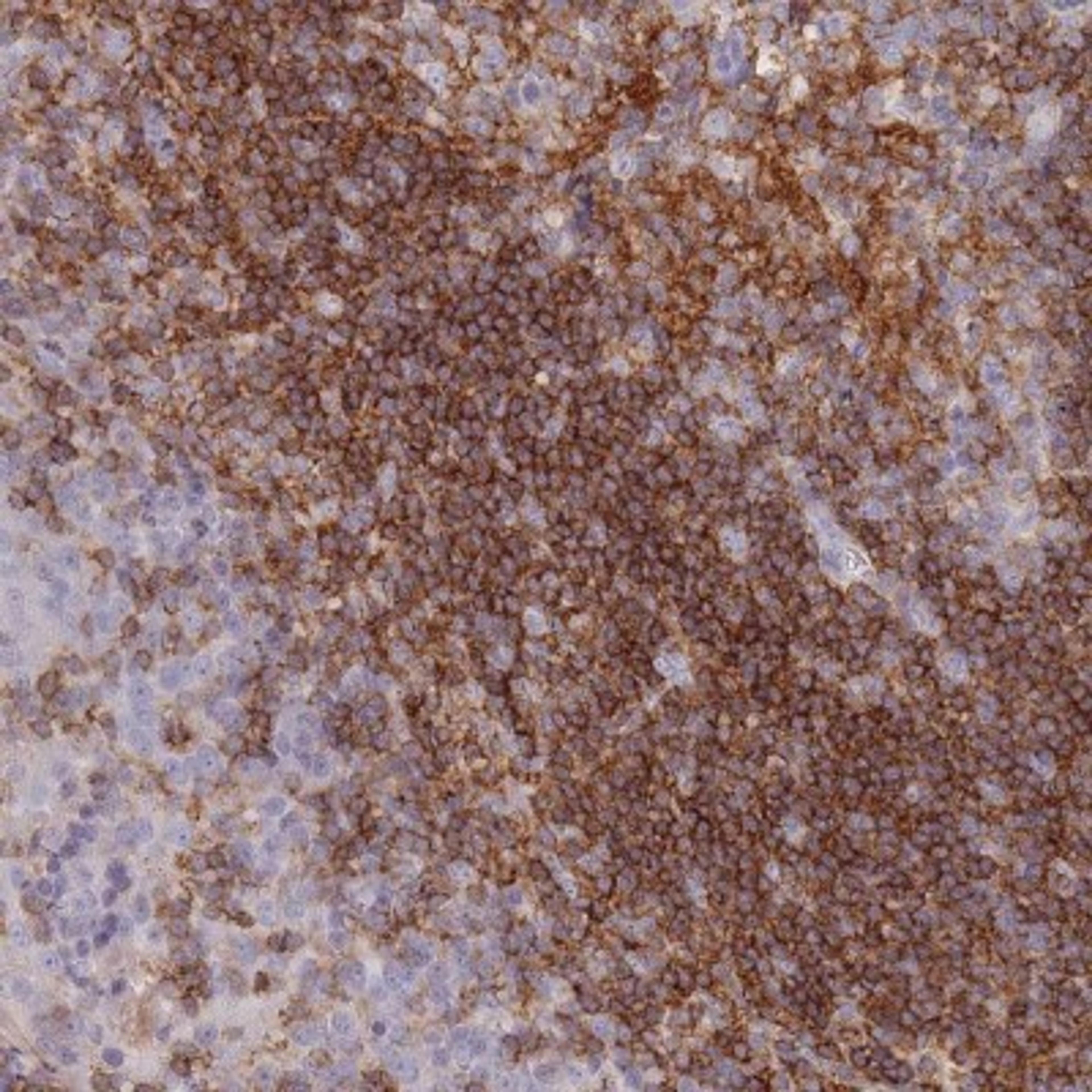 Immunohistochemistry-Paraffin: CD37 Antibody [NBP2-33970] - Immunohistochemical staining of human tonsil shows moderate cytoplasmic positivity in germinal center cells and strong cytoplasmic staining in non-germinal center cells.