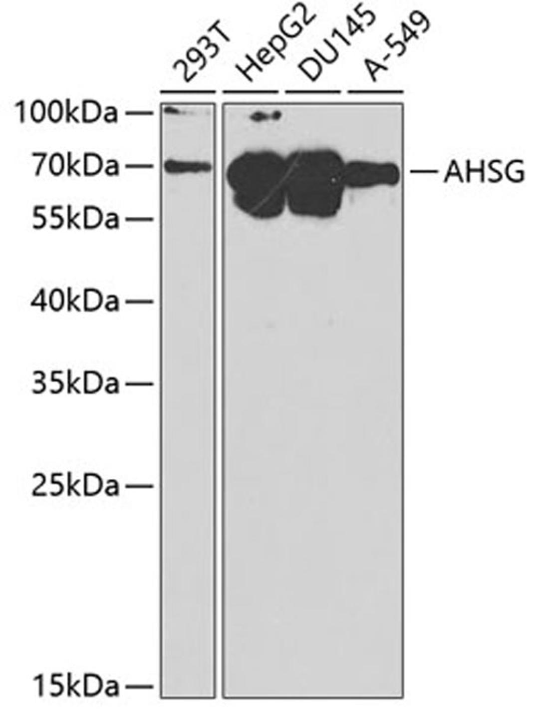 Western blot - AHSG antibody (A1647)