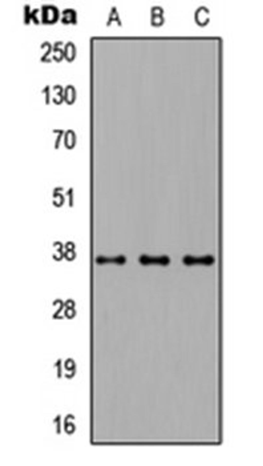 Western blot analysis of HEK293T (Lane 1), NS-1 (Lane 2), PC12 (Lane 3) whole cell lysates using CD66c antibody