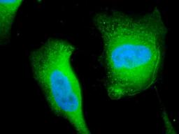 Immunofluorescence analysis of hela cells using Calcineurin A antibody