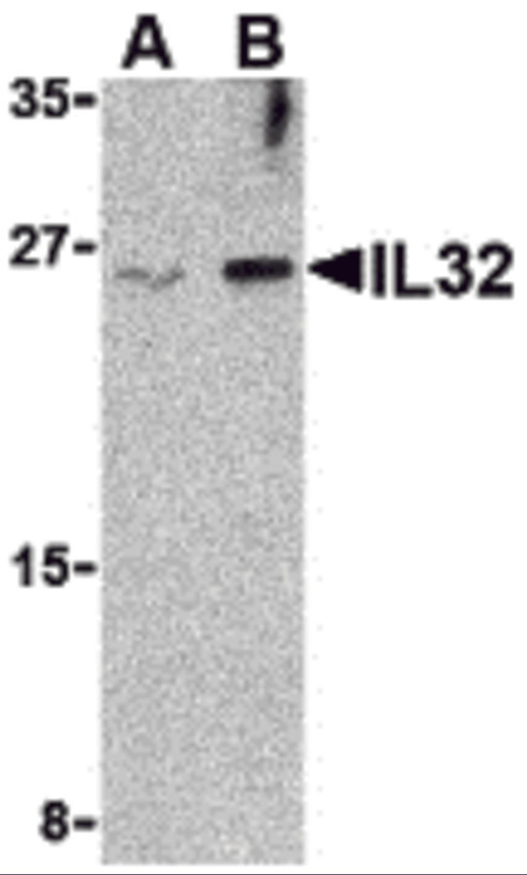 Western blot analysis of IL-32 in Jurkat cell lysate with IL-32 antibody at (A) 2.5 and (B) 5 μg/mL.