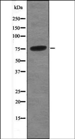 Western blot analysis of Nocodazole treated A549 whole cell lysates using B-Myb -Phospho-Thr494/497- antibody