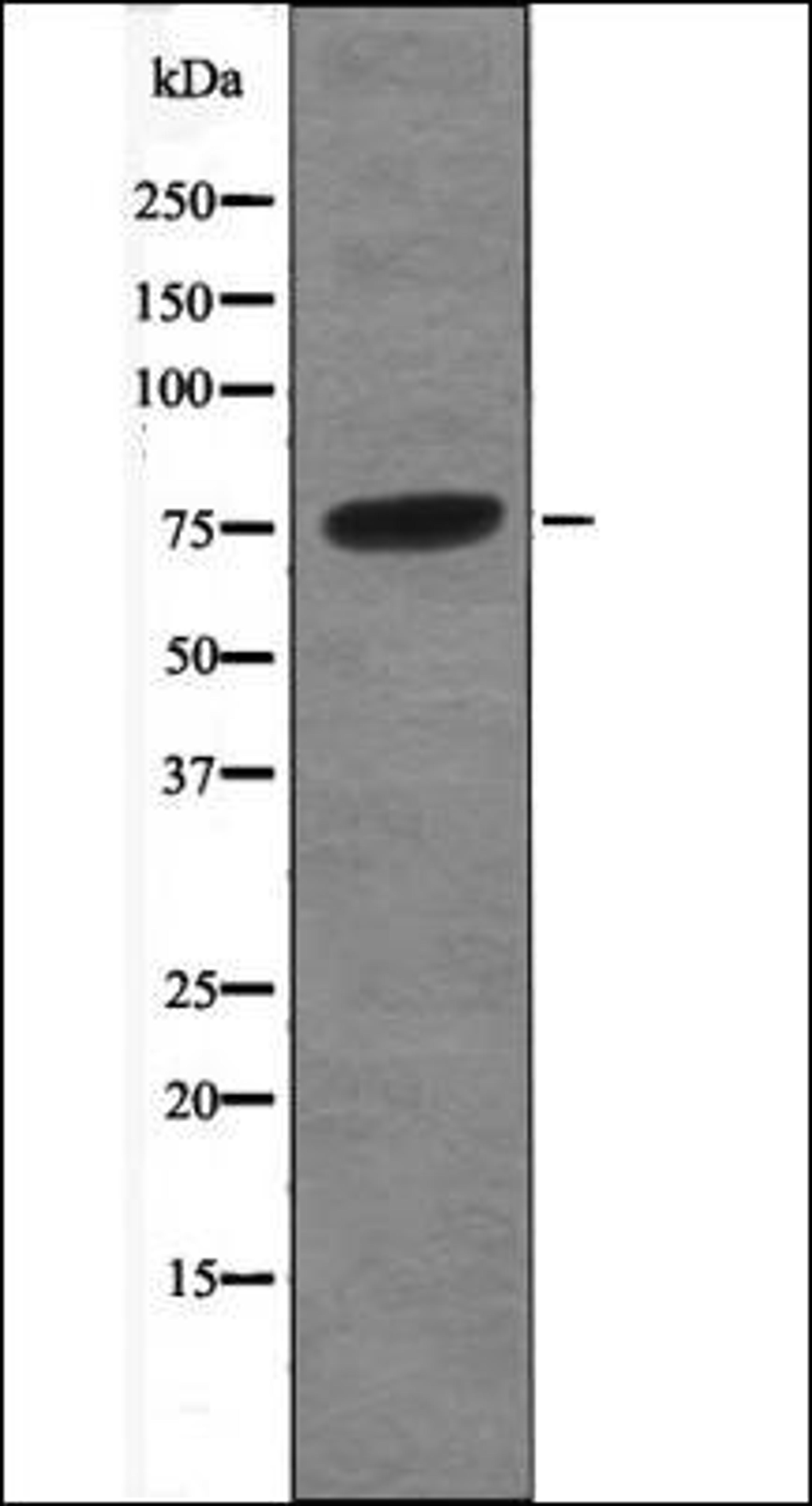 Western blot analysis of Nocodazole treated A549 whole cell lysates using B-Myb -Phospho-Thr494/497- antibody