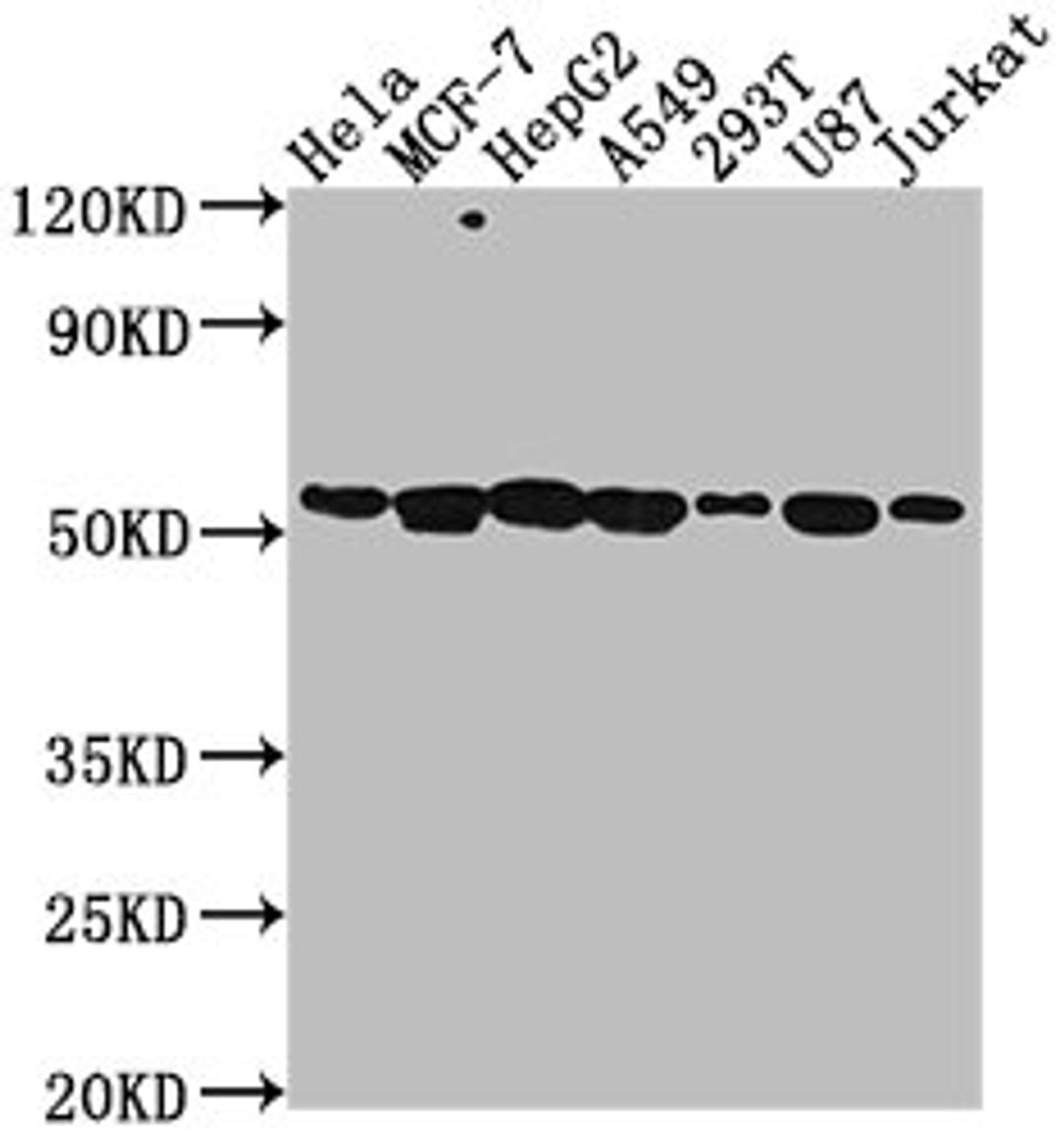 Western Blot. Positive WB detected in: Hela whole cell lysate, MCF-7 whole cell lysate, HepG2 whole cell lysate, A549 whole cell lysate, 293T whole cell lysate, U87 whole cell lysate, Jurkat whole cell lysate. All lanes: PRAMEF6 antibody at 1:2000. Secondary. Goat polyclonal to rabbit IgG at 1/50000 dilution. Predicted band size: 55 kDa. Observed band size: 55 kDa. 