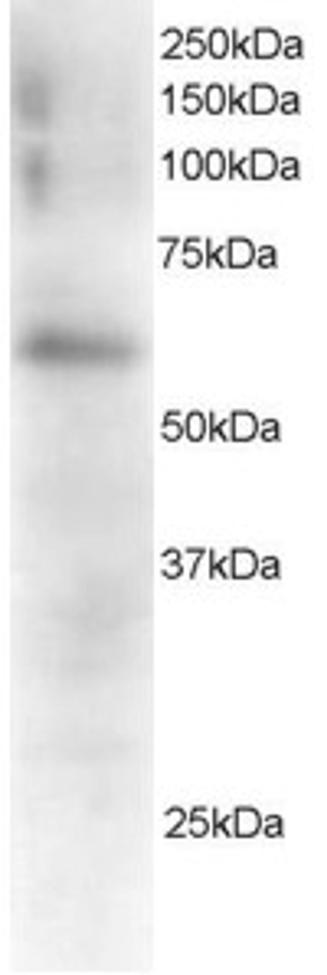 45-590 staining (0.5ug/ml) of Mouse Spleen extracts (RIPA buffer, 35ug total protein per lane). Primary incubated for 1 hour. Detected by western blot using chemiluminescence.