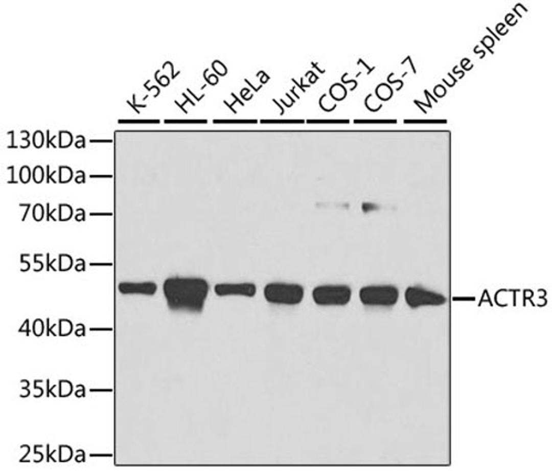 Western blot - ACTR3 antibody (A1064)