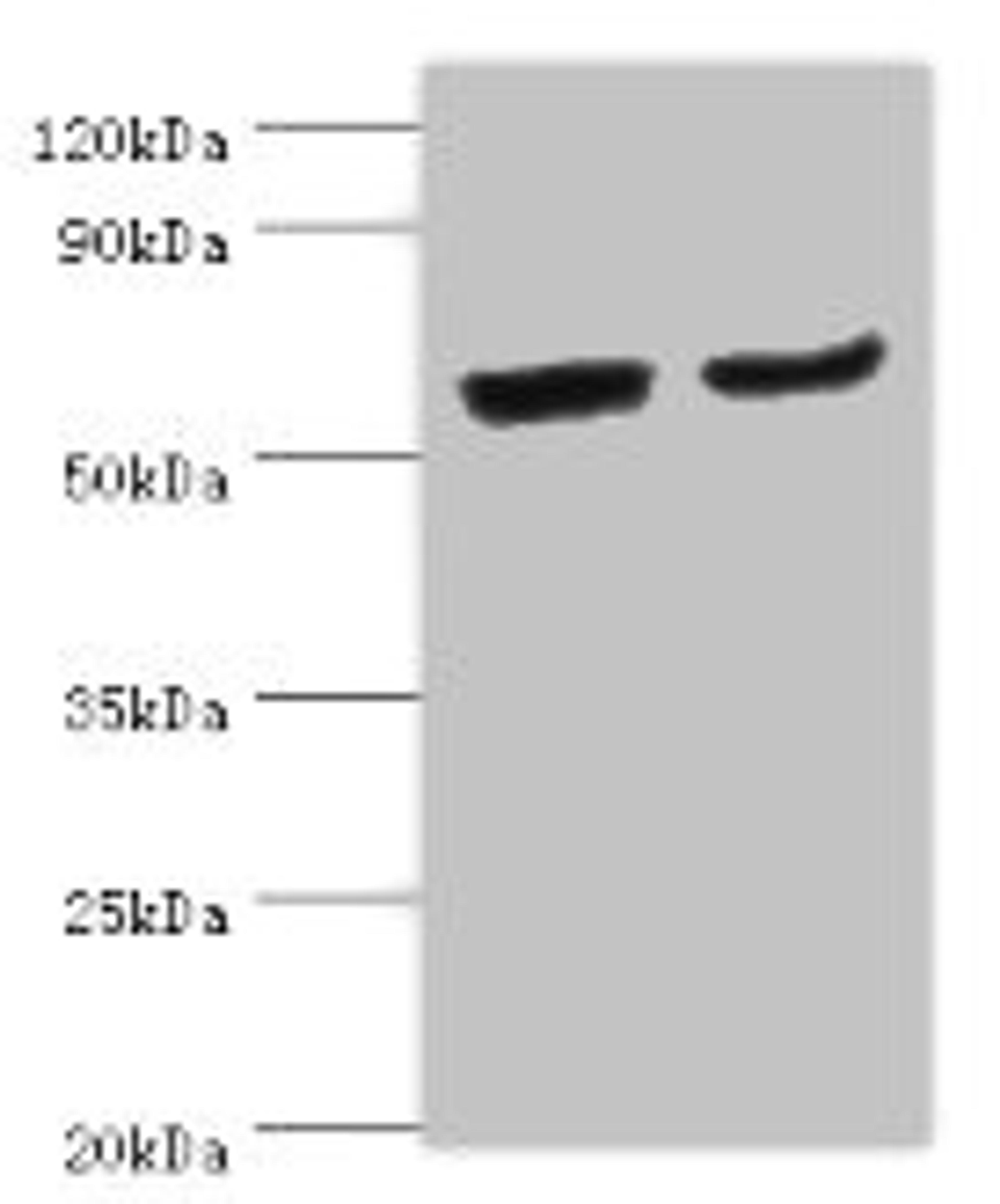 Western blot. All lanes: CYP2J2 antibody at 4ug/ml. Lane 1: Mouse skeletal muscle tissue. Lane 2: Rat liver tissue. Secondary. Goat polyclonal to rabbit IgG at 1/10000 dilution. Predicted band size: 58 kDa. Observed band size: 58 kDa. 