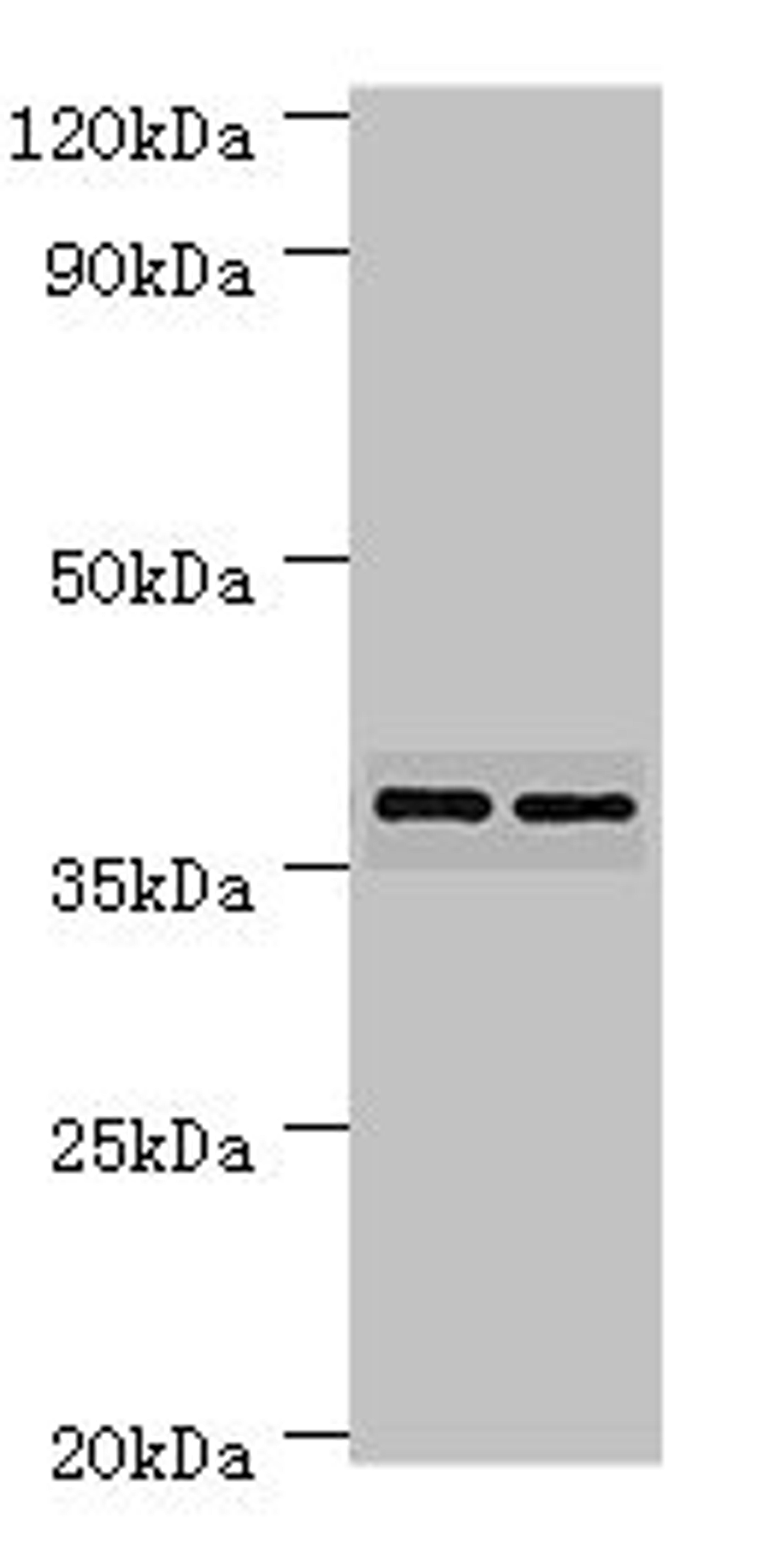 Western blot. All lanes: MAP2K3 antibody at 7ug/ml. Lane 1: MCF-7 whole cell lysate. Lane 2: COLO320 whole cell lysate. Secondary. Goat polyclonal to rabbit IgG at 1/10000 dilution. Predicted band size: 40, 37 kDa. Observed band size: 40 kDa. 