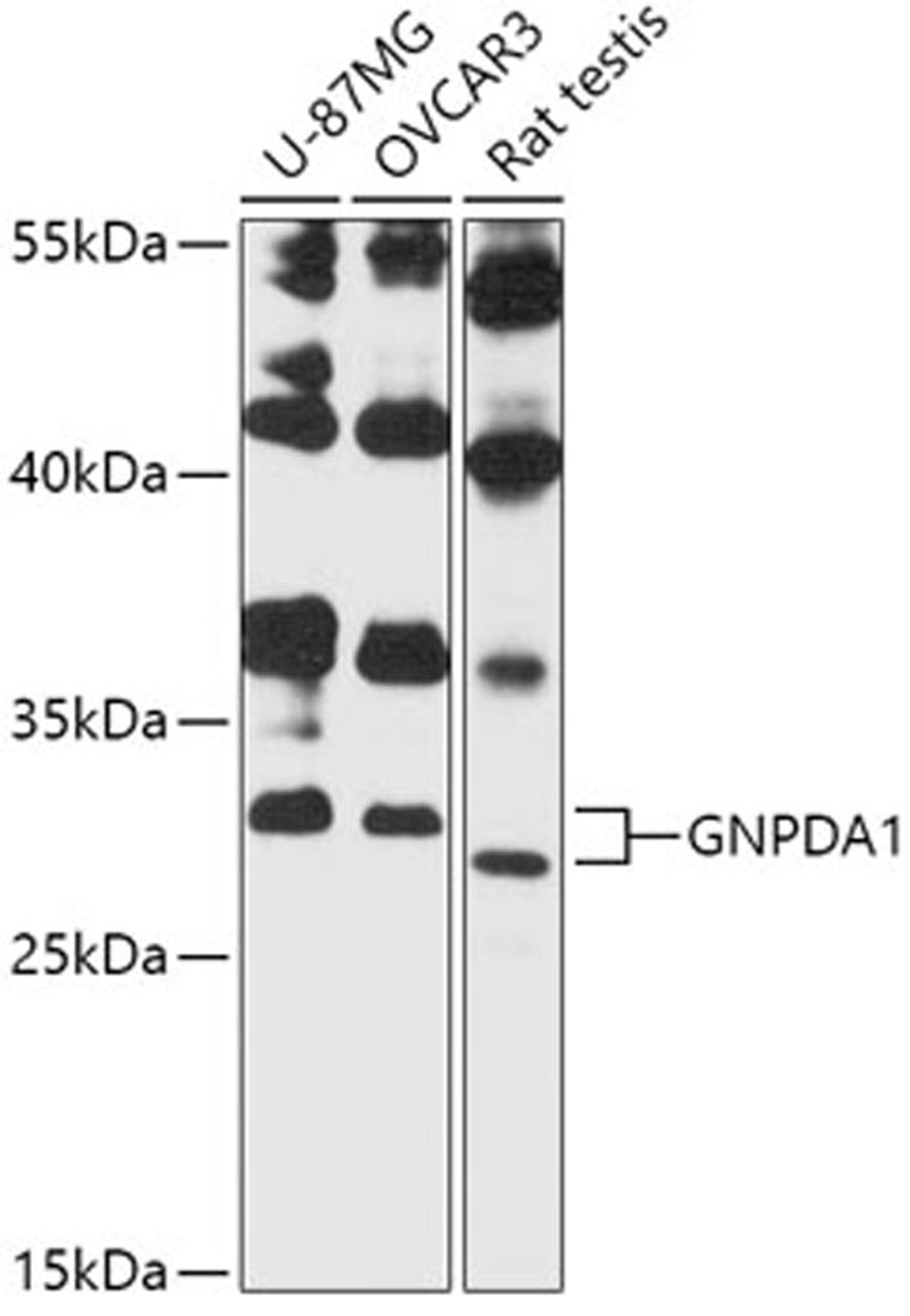 Western blot - GNPDA1 antibody (A13717)