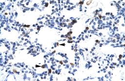 Antibody used in IHC on Human Lung.