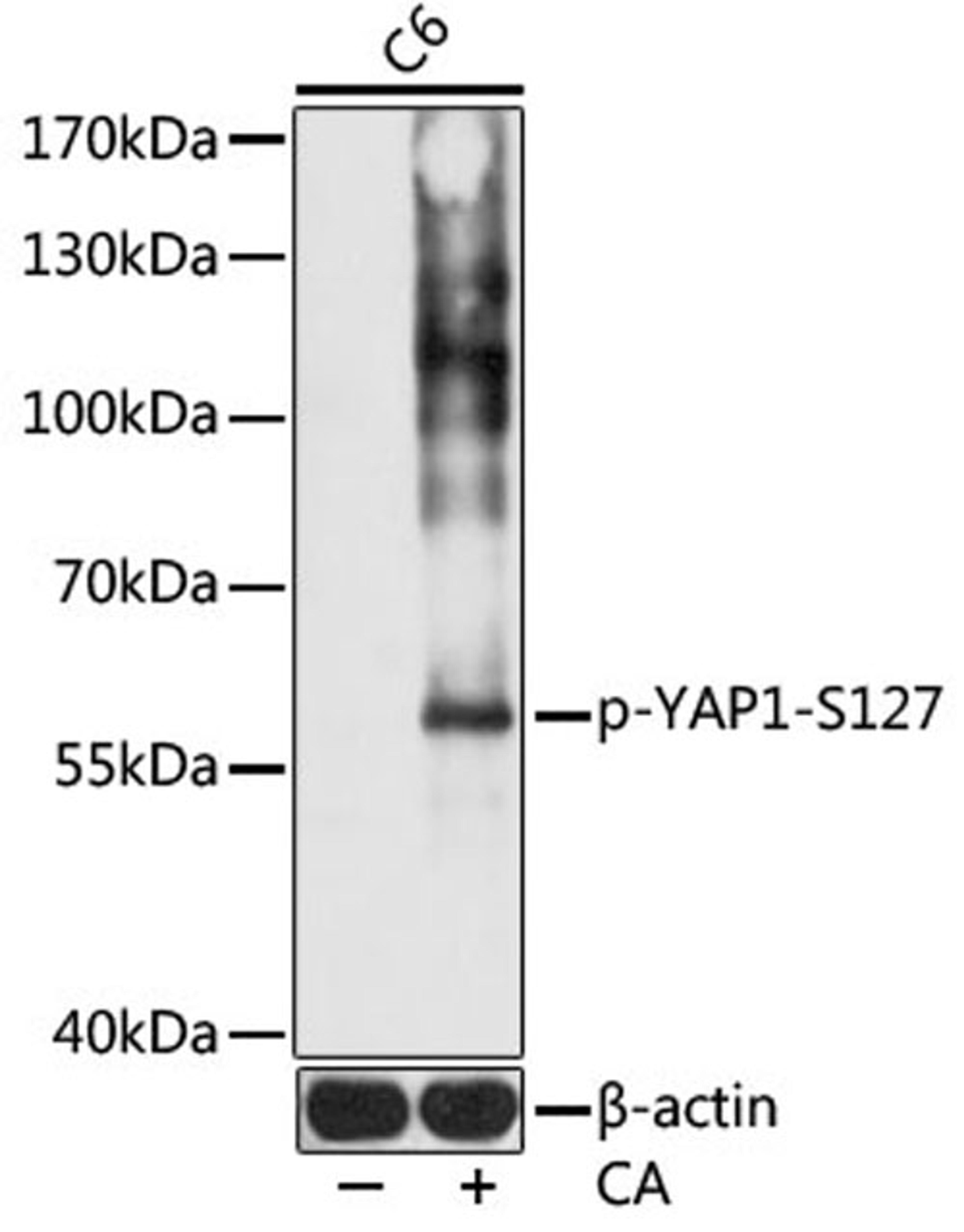 Western blot - Phospho-YAP1-S127 pAb (AP0489)