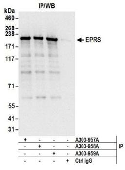 Detection of human EPRS by western blot of immunoprecipitates.