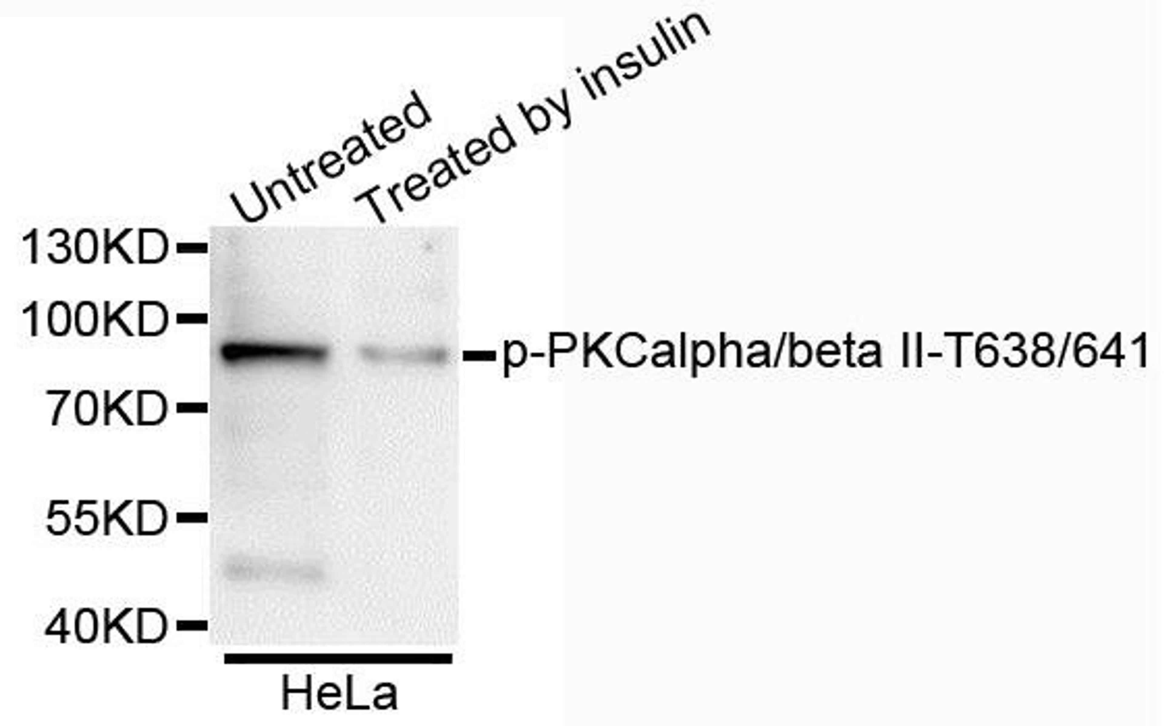 Western blot analysis of extracts of HeLa cells using PKCalpha/beta II (Phospho-T638/641) antibody