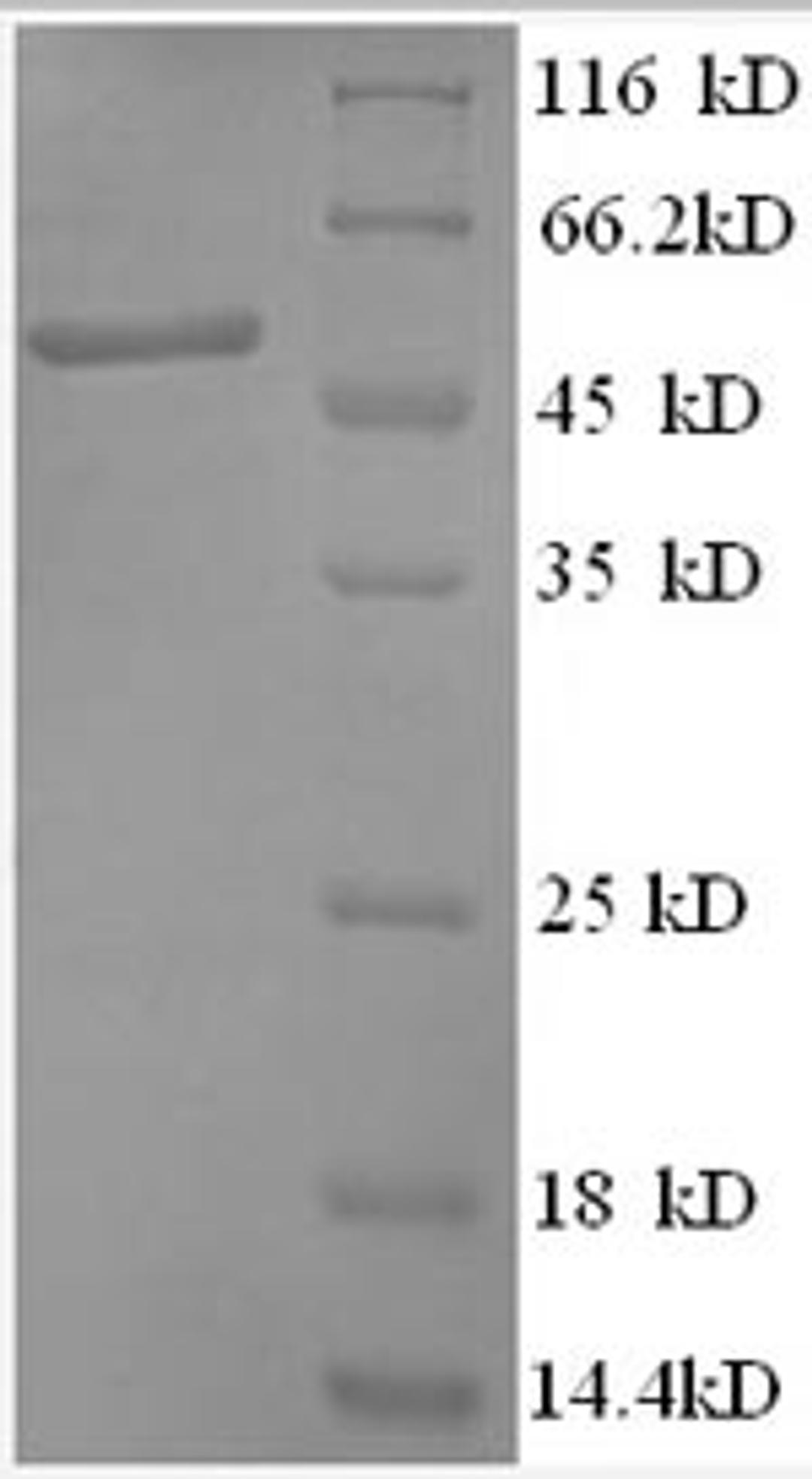 (Tris-Glycine gel) Discontinuous SDS-PAGE (reduced) with 5% enrichment gel and 15% separation gel.