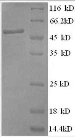 (Tris-Glycine gel) Discontinuous SDS-PAGE (reduced) with 5% enrichment gel and 15% separation gel.