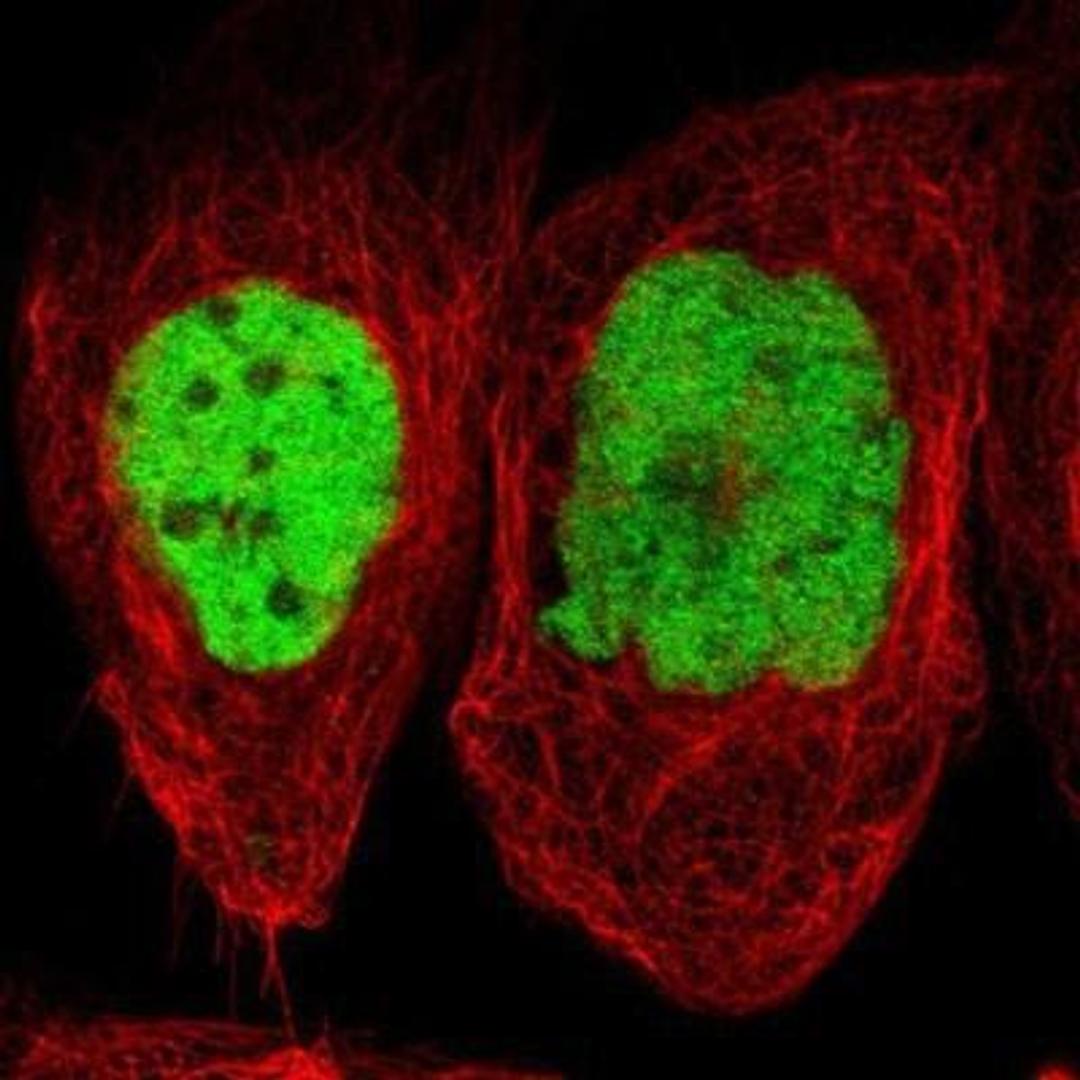 Immunocytochemistry/Immunofluorescence: AP-1 Antibody [NBP1-89544] - AP-1 Antibody Staining of human cell line A-431 shows positivity in nuclei but not nucleoli.