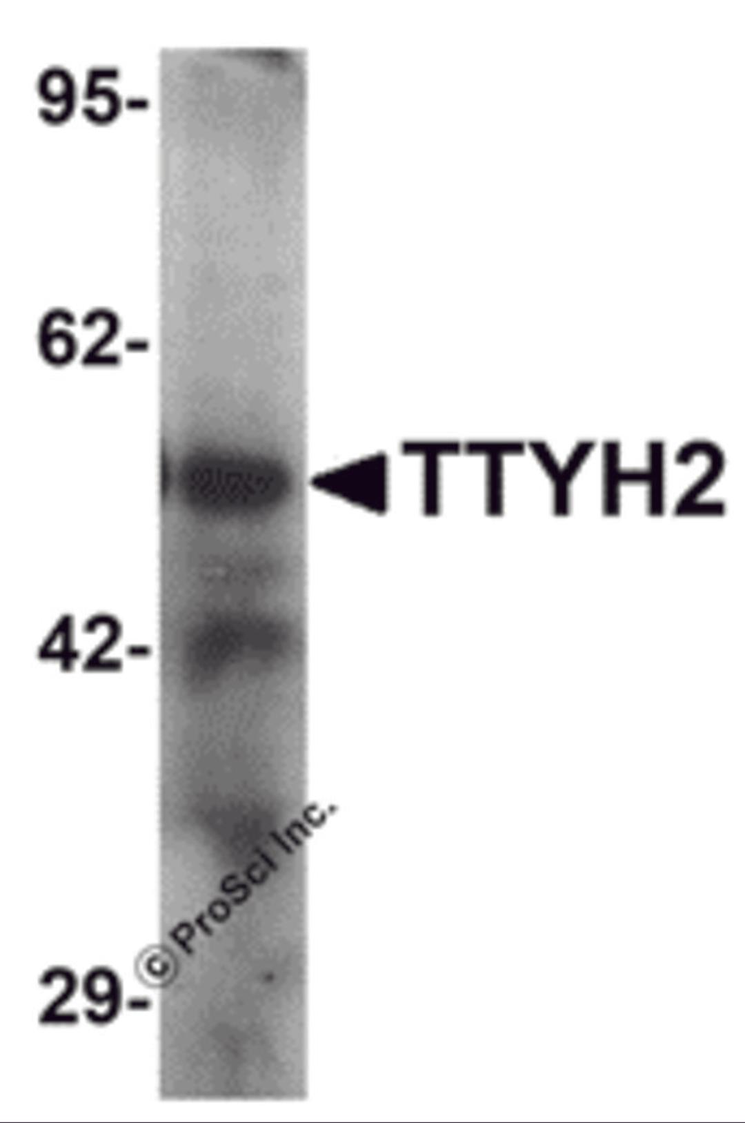 Western blot analysis of TTYH2 in human kidney tissue lysate with TTYH2 antibody at 1 μg/ml