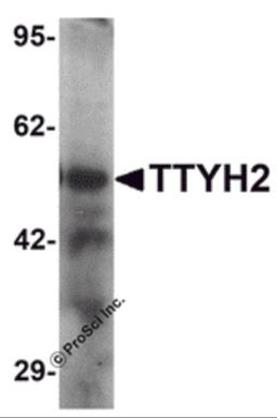 Western blot analysis of TTYH2 in human kidney tissue lysate with TTYH2 antibody at 1 μg/ml