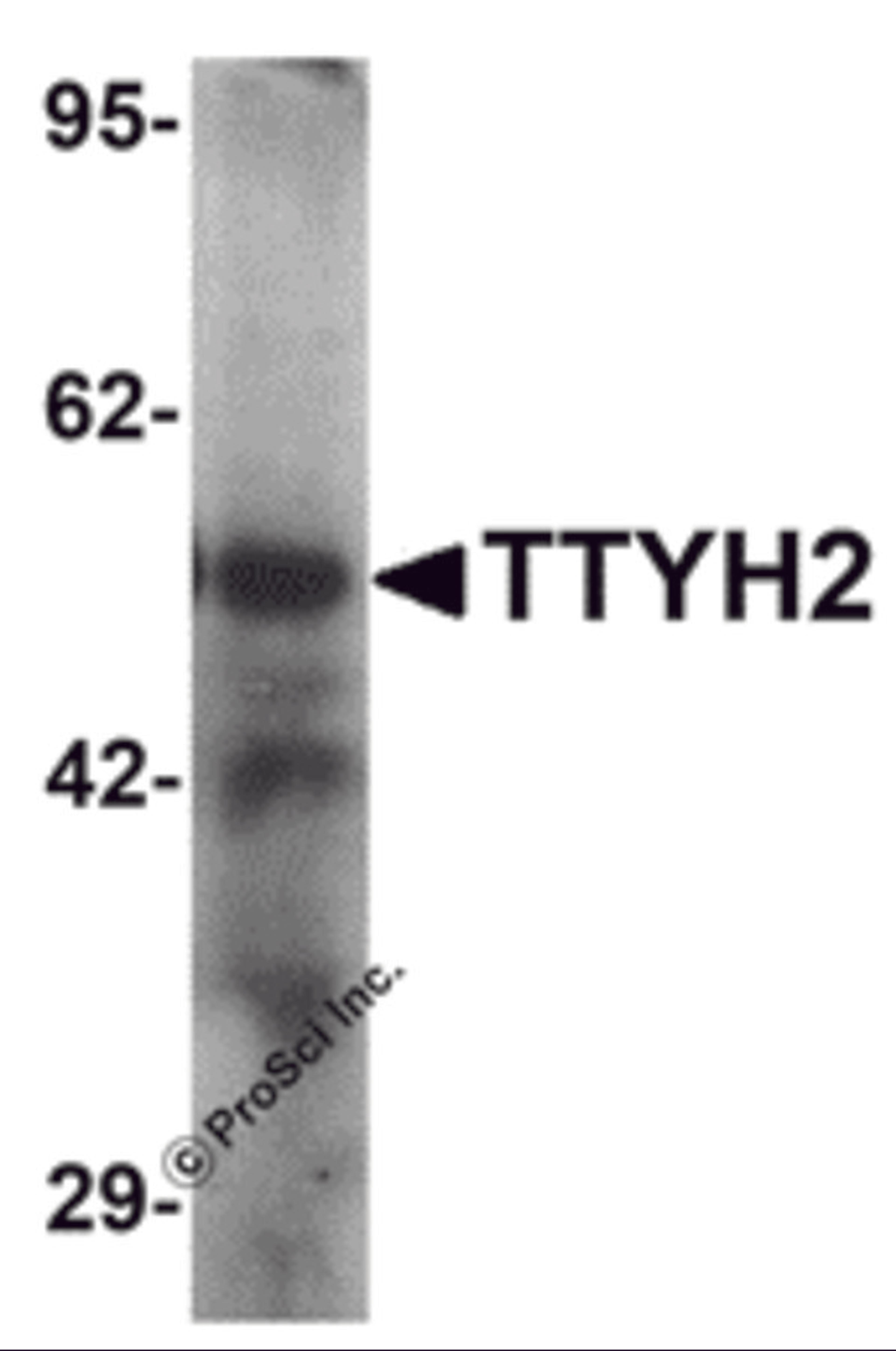 Western blot analysis of TTYH2 in human kidney tissue lysate with TTYH2 antibody at 1 μg/ml