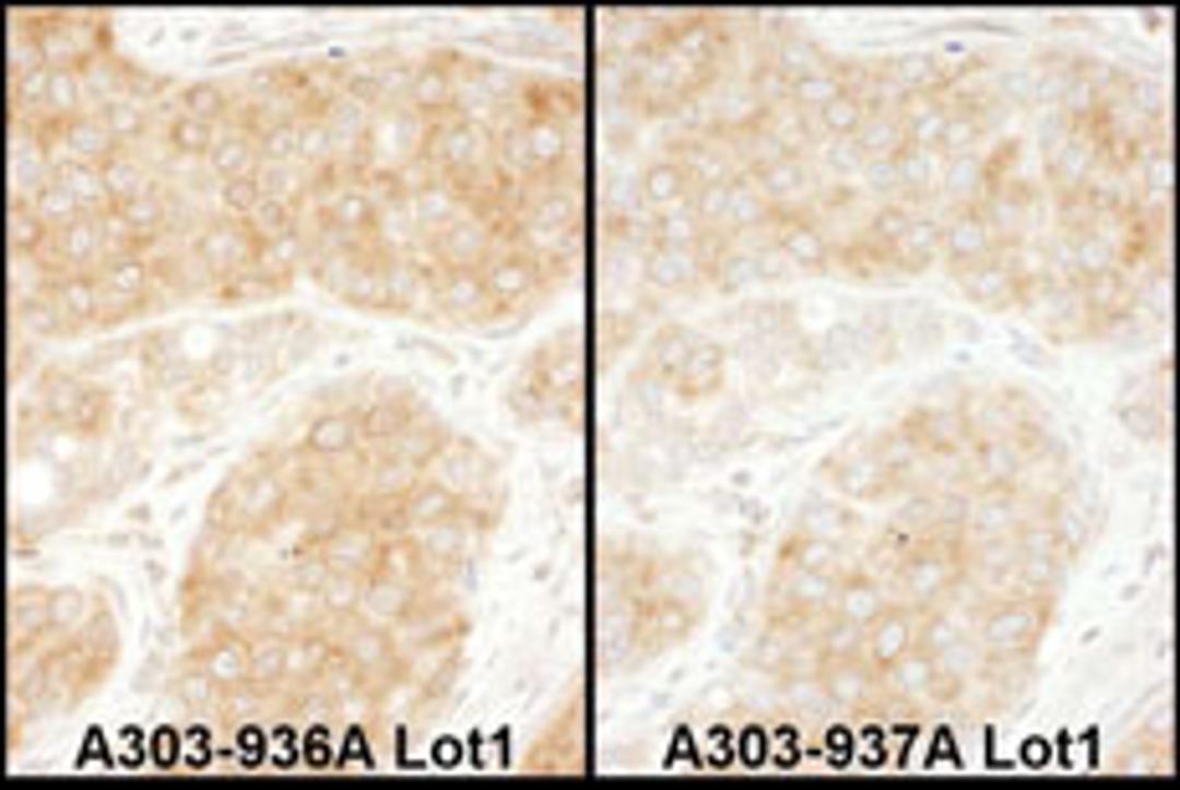 Detection of human RPS11 by immunohistochemistry.