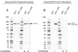 Western Blot analysis of A431 untreated and EGF treated whole cell lysates