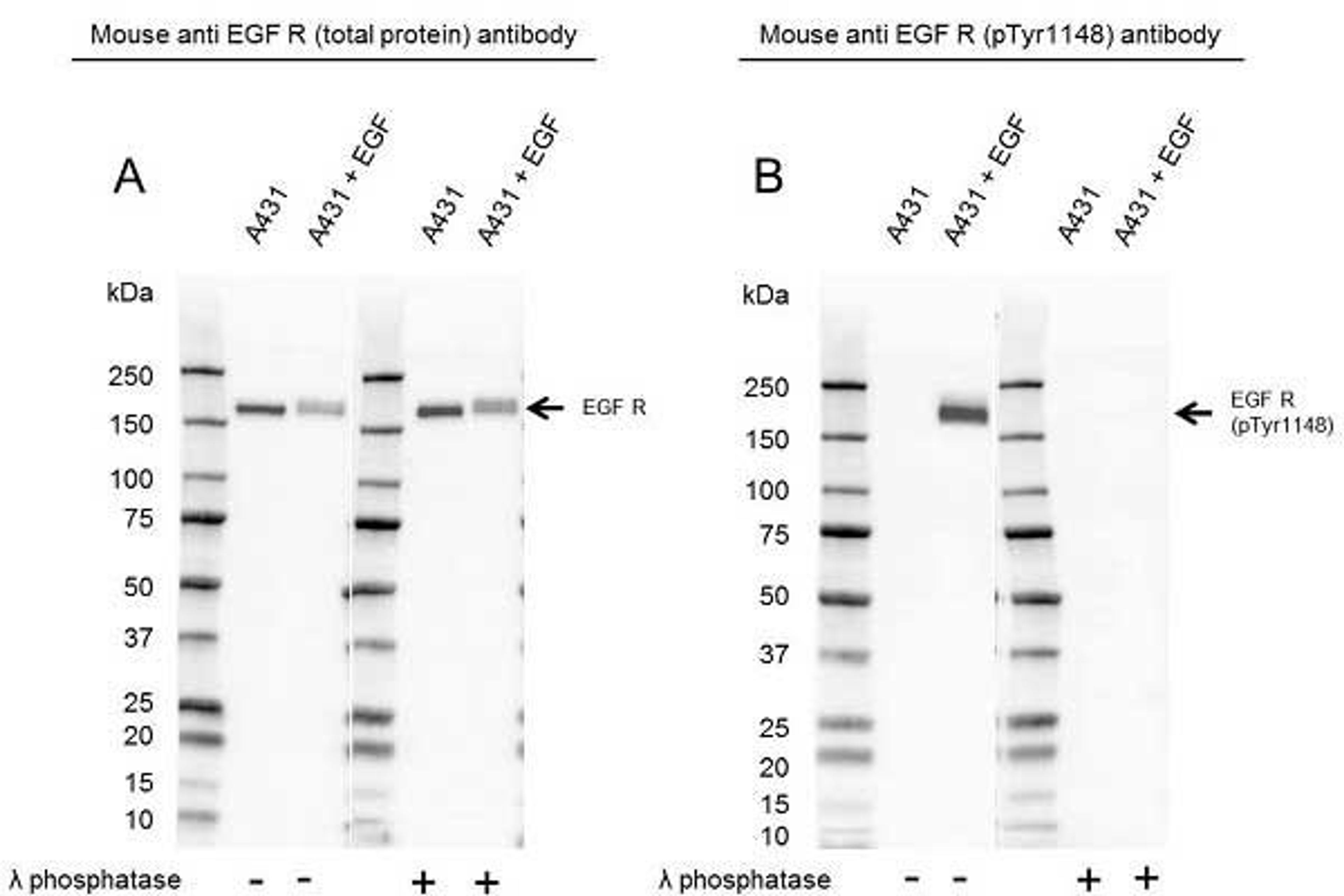 Western Blot analysis of A431 untreated and EGF treated whole cell lysates