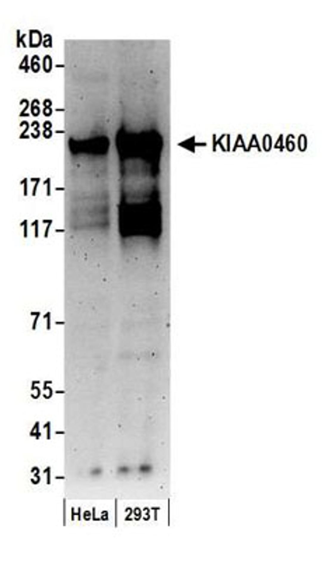 Detection of human KIAA0460 by western blot.