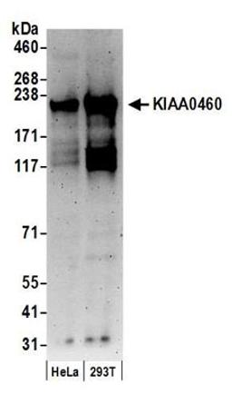 Detection of human KIAA0460 by western blot.