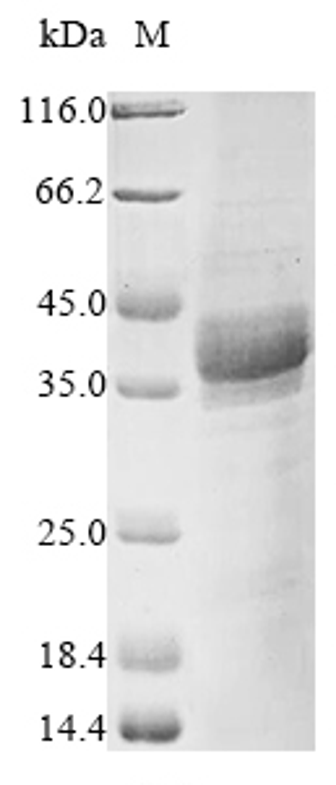 (Tris-Glycine gel) Discontinuous SDS-PAGE (reduced) with 5% enrichment gel and 15% separation gel.