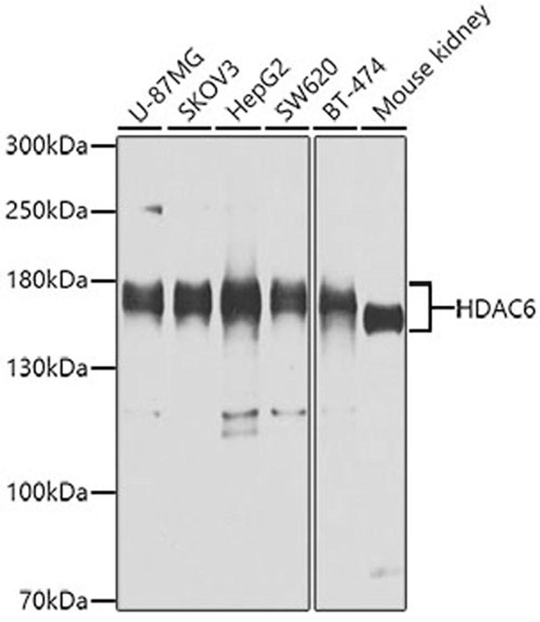 Western blot - HDAC6 antibody (A11259)