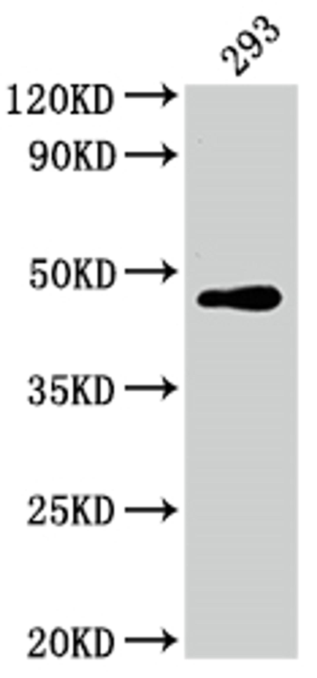 Western Blot. Positive WB detected in: 293 whole cell lysate. All lanes: JUN antibody at 1:2000. Secondary. Goat polyclonal to rabbit IgG at 1/50000 dilution. Predicted band size: 36 kDa. Observed band size: 43 kDa. 