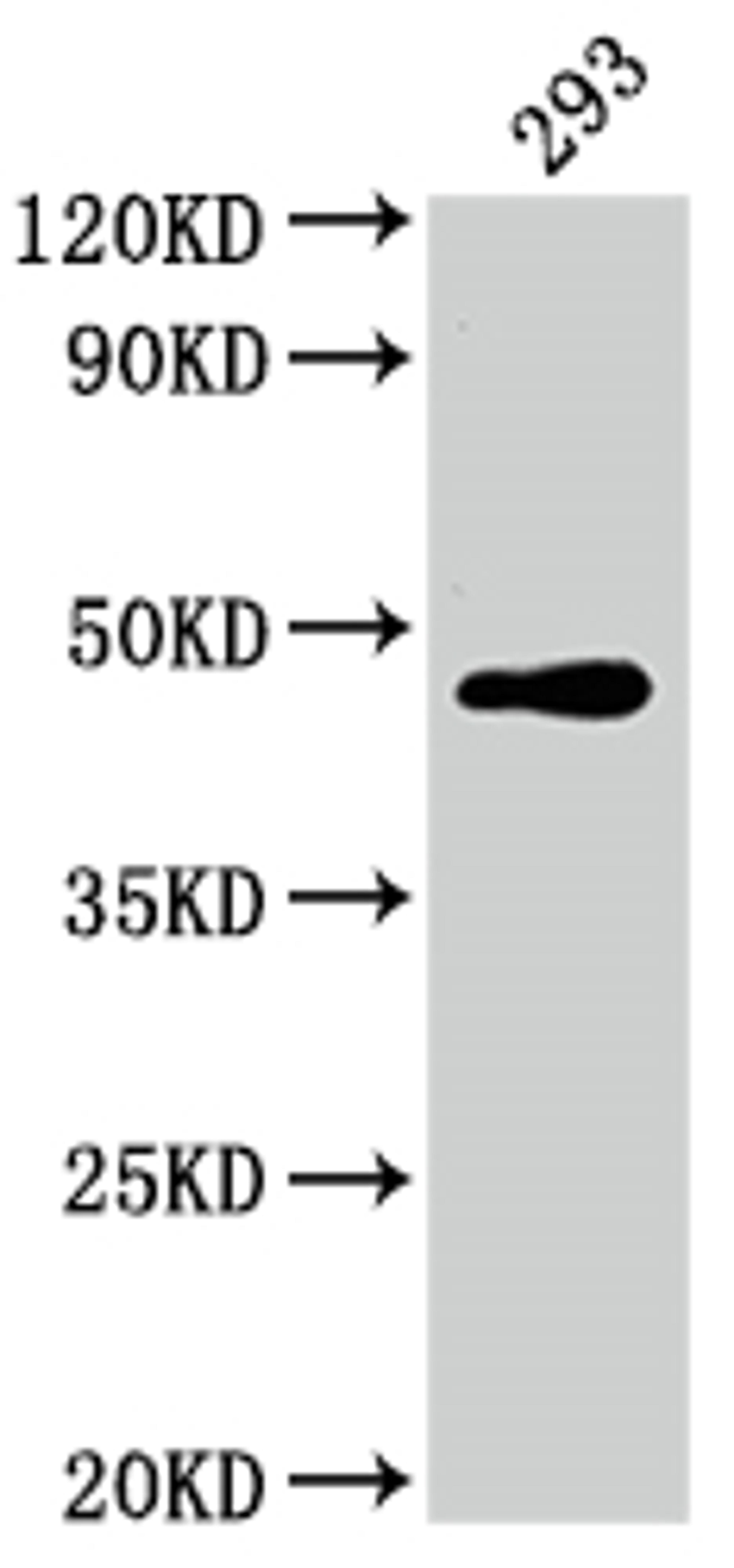 Western Blot. Positive WB detected in: 293 whole cell lysate. All lanes: JUN antibody at 1:2000. Secondary. Goat polyclonal to rabbit IgG at 1/50000 dilution. Predicted band size: 36 kDa. Observed band size: 43 kDa. 