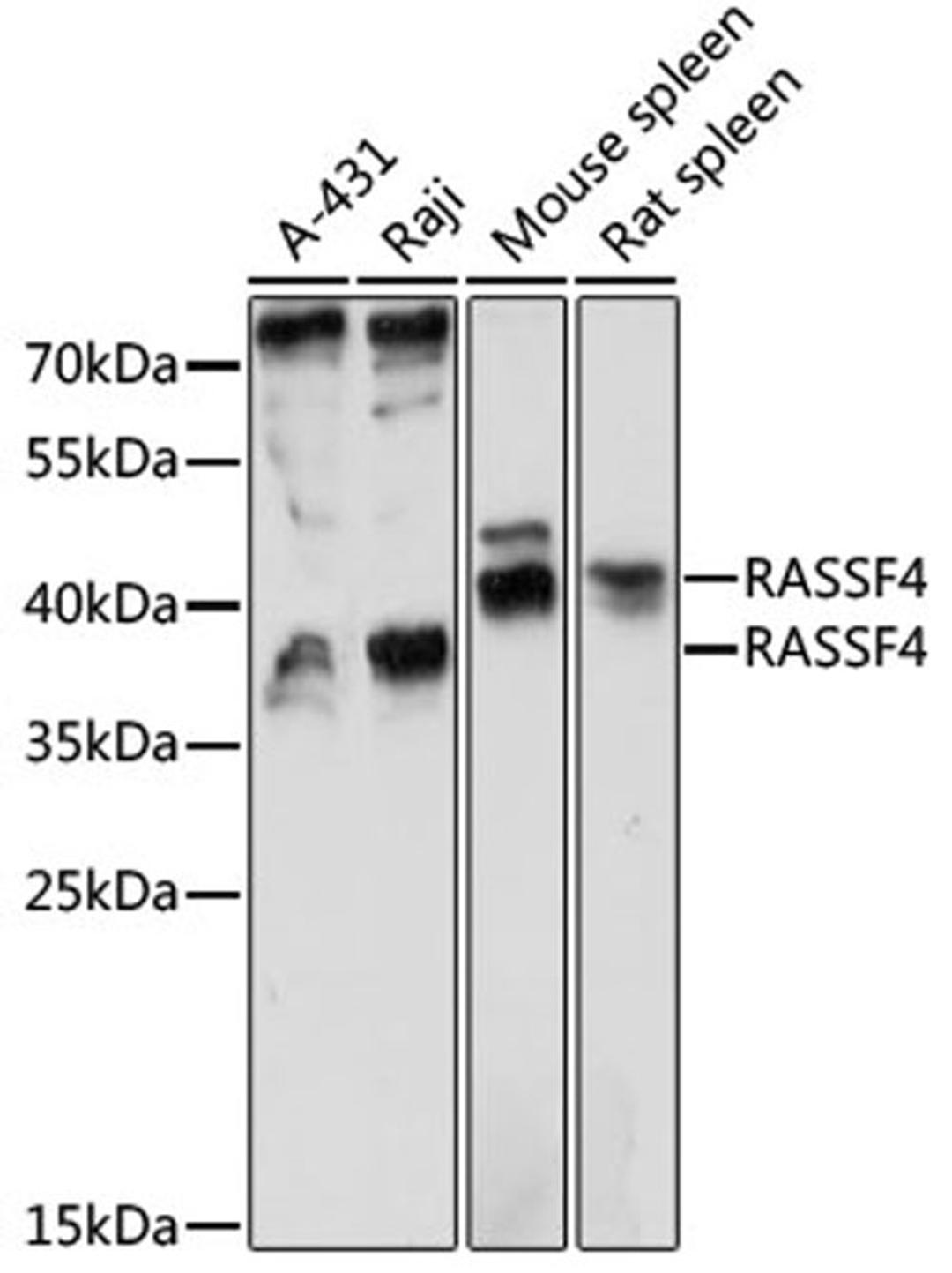 Western blot - RASSF4 antibody (A14943)