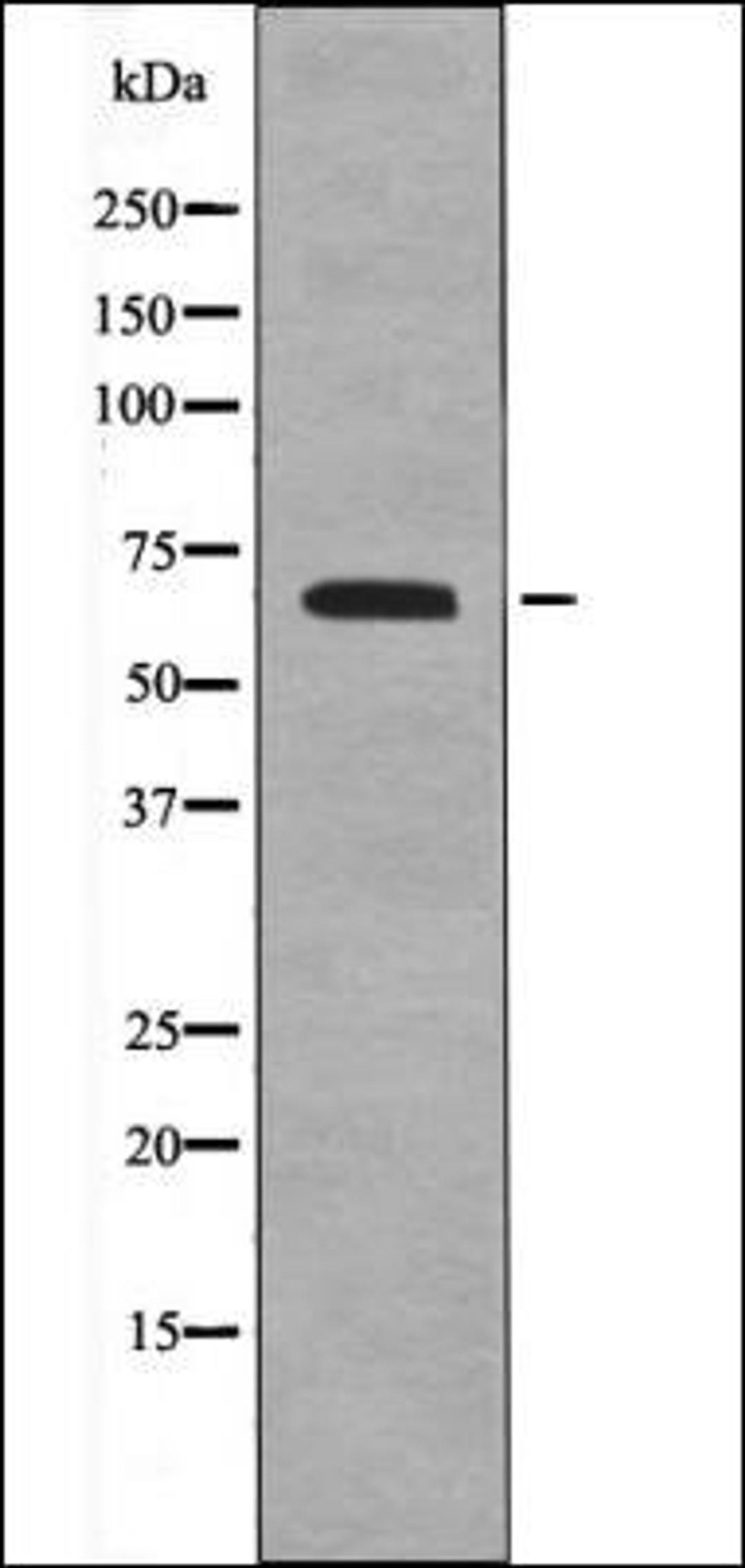 Western blot analysis of EGF treated NIH-3T3 whole cell lysates using FRS2 -Phospho-Tyr196- antibody